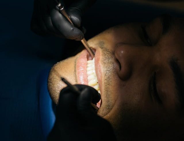 Jakie zęby można poprawić bondingiem?