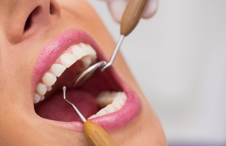 rodzaje koron zębowych